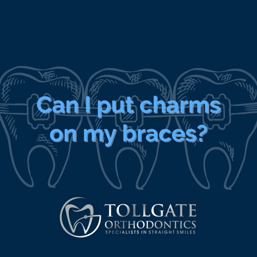 This is the image for the news article titled Can I Add Charms to My Braces?