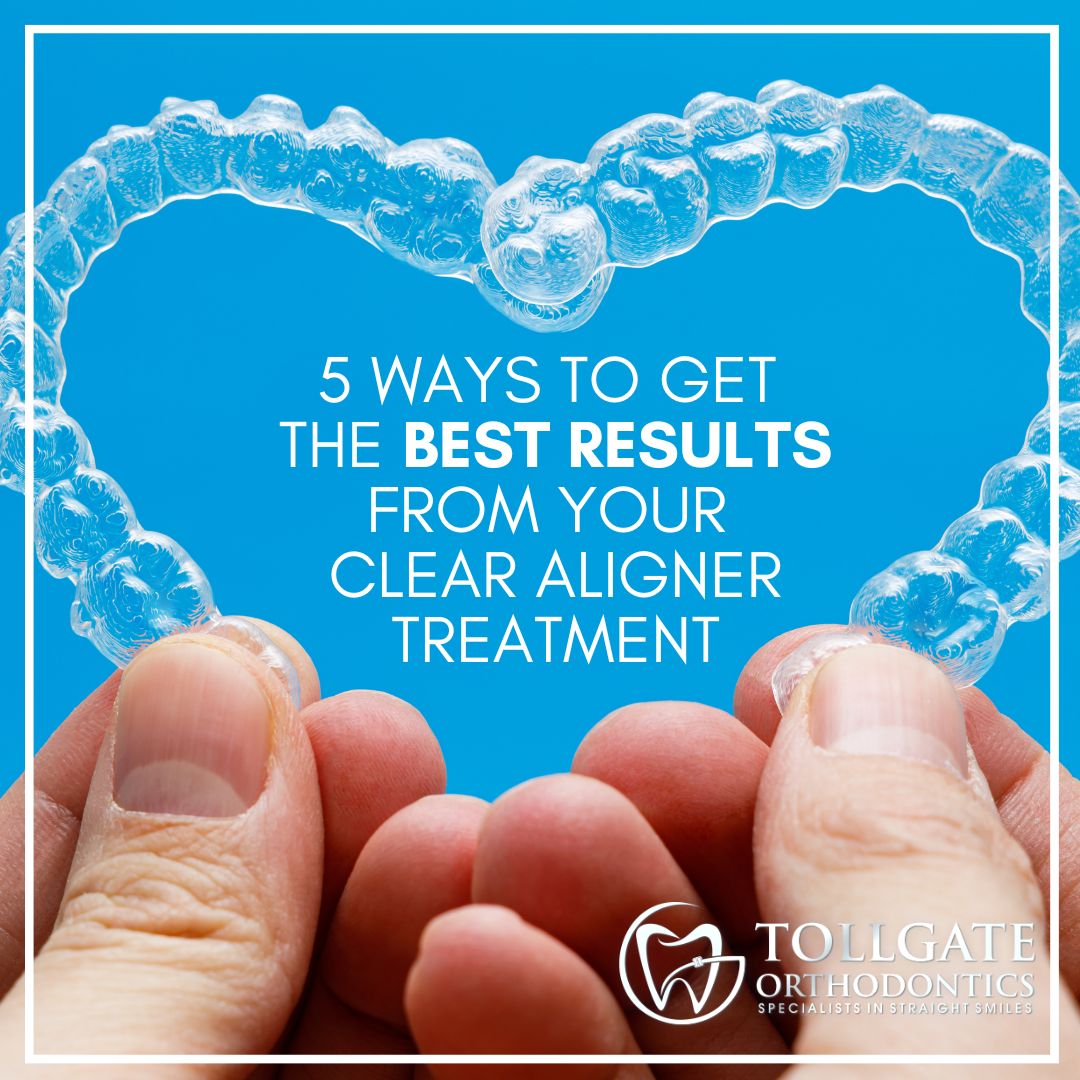 This is the image for the news article titled 5 Ways to Get the Best Results From Your Clear Aligners