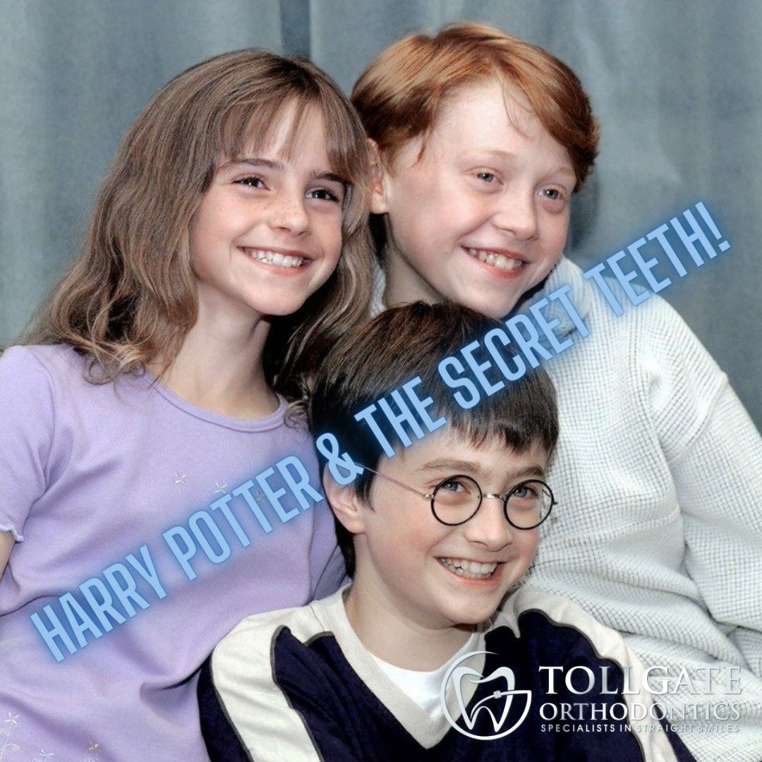 This is the image for the news article titled Harry Potter And The Secret Teeth