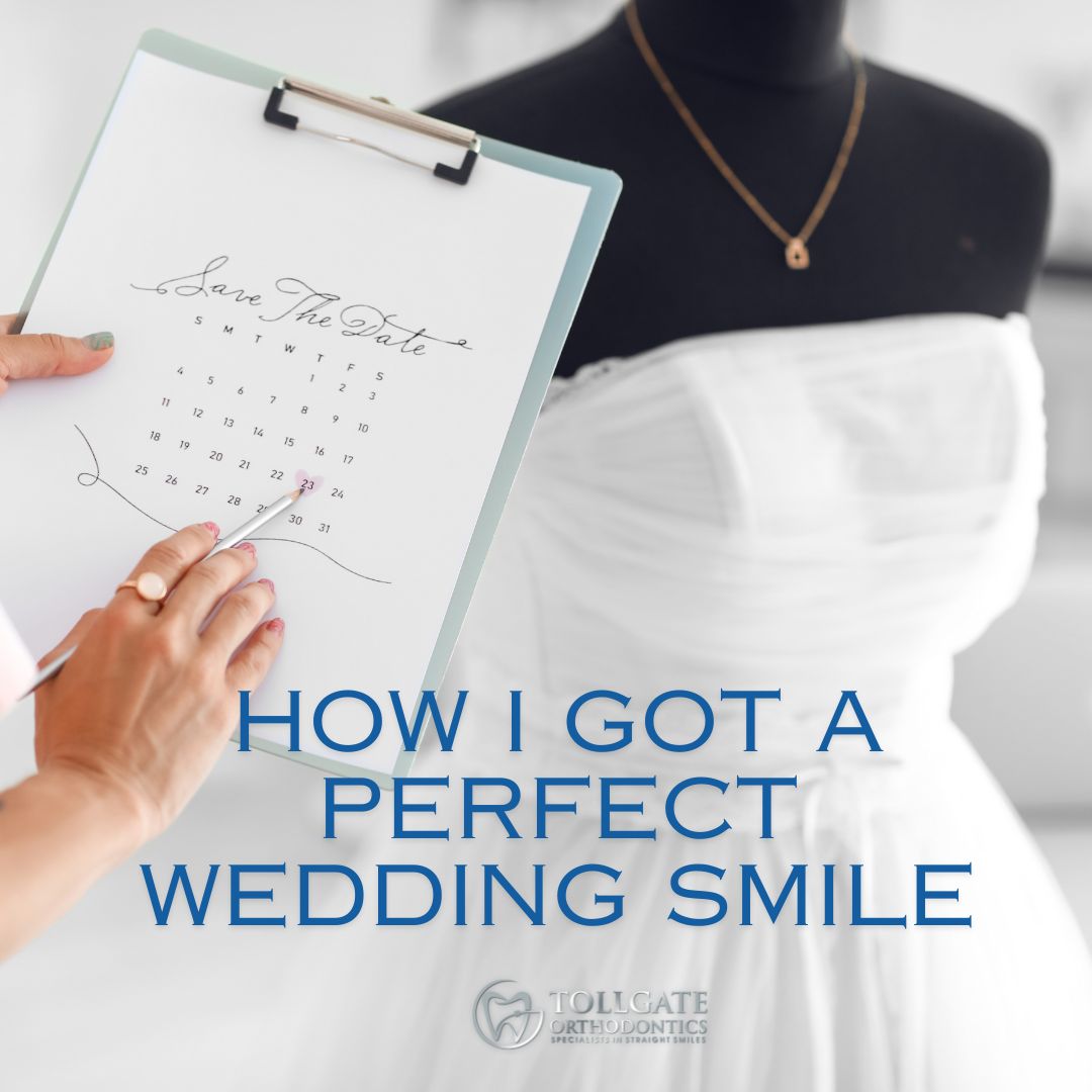 This is the image for the news article titled Countdown to a Perfect Wedding Smile