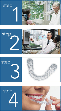 Invisalign® Clear Aligners four-step process.