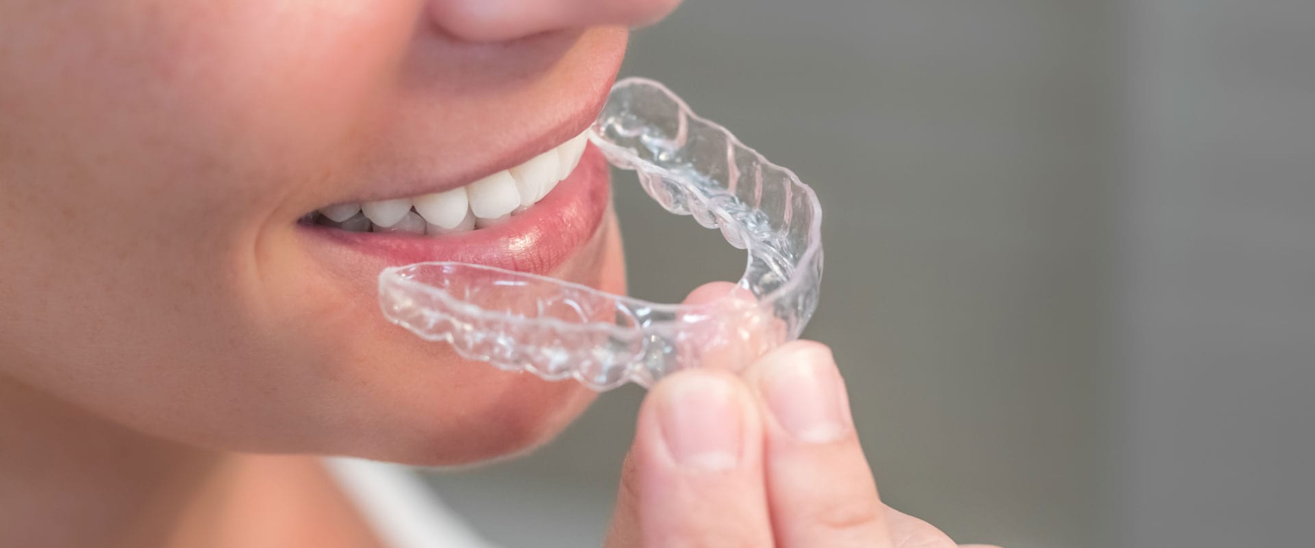 Woman with Aligner